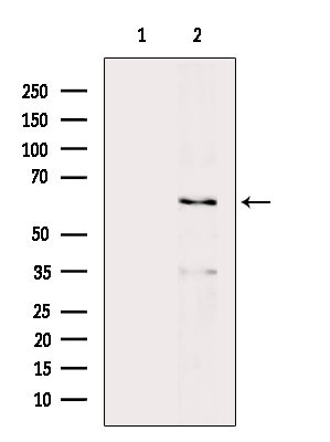 Phospho-AMPK alpha-1,2 (Thr172) Antibody in Western Blot (WB)