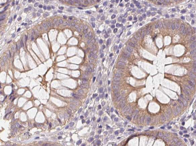 Phospho-AMPK alpha-1,2 (Thr172) Antibody in Immunohistochemistry (Paraffin) (IHC (P))