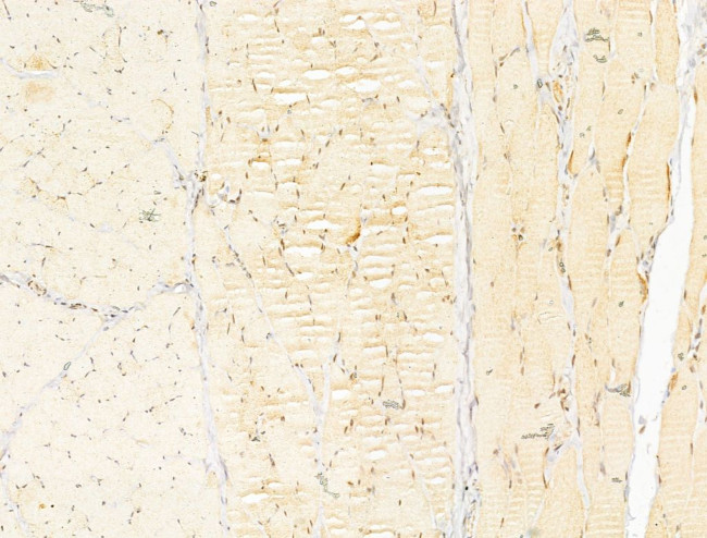 Phospho-AMPK alpha-1,2 (Thr172) Antibody in Immunohistochemistry (Paraffin) (IHC (P))