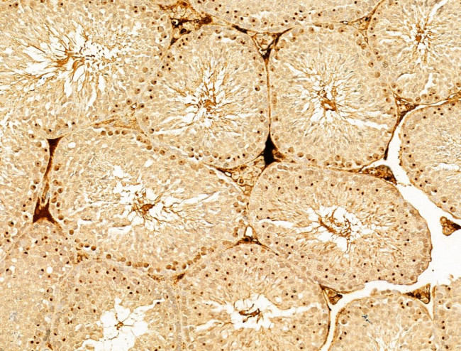 Phospho-AMPK alpha-1,2 (Thr172) Antibody in Immunohistochemistry (Paraffin) (IHC (P))