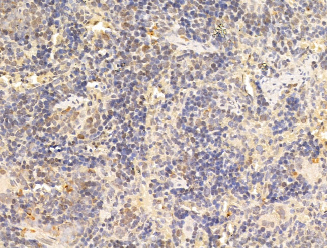 Phospho-AMPK alpha-1,2 (Thr172) Antibody in Immunohistochemistry (Paraffin) (IHC (P))