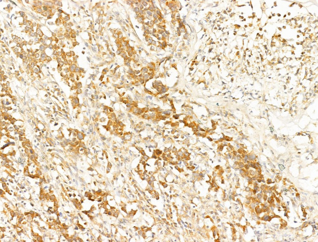 Phospho-AMPK alpha-1,2 (Thr172) Antibody in Immunohistochemistry (Paraffin) (IHC (P))