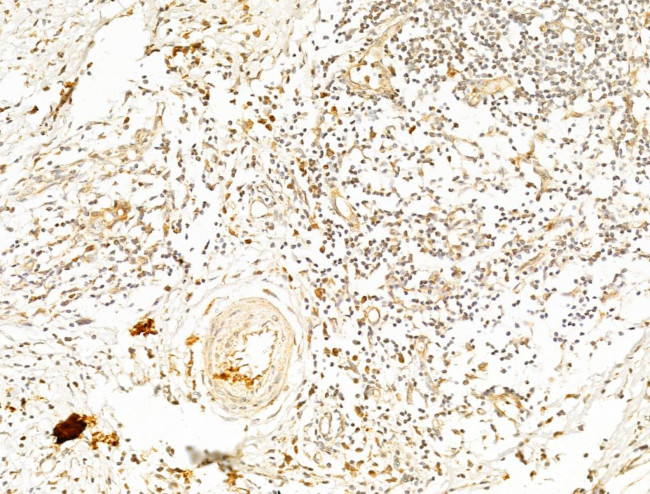 Phospho-AMPK alpha-1,2 (Thr172) Antibody in Immunohistochemistry (Paraffin) (IHC (P))