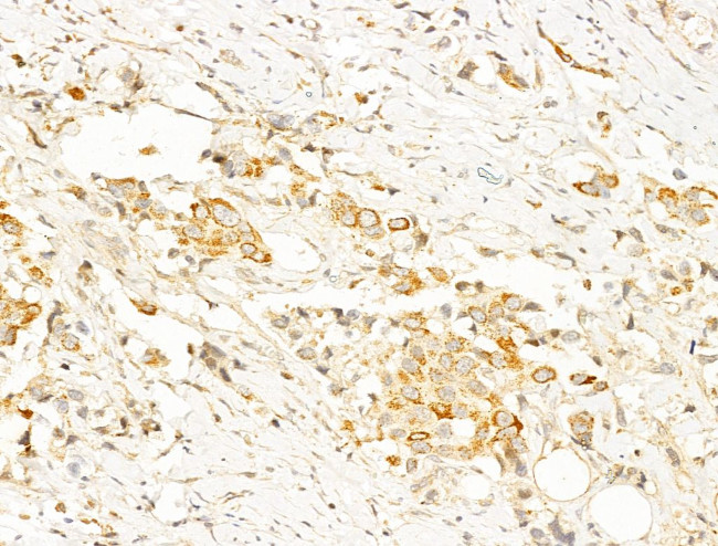 Phospho-AMPK alpha-1,2 (Thr172) Antibody in Immunohistochemistry (Paraffin) (IHC (P))