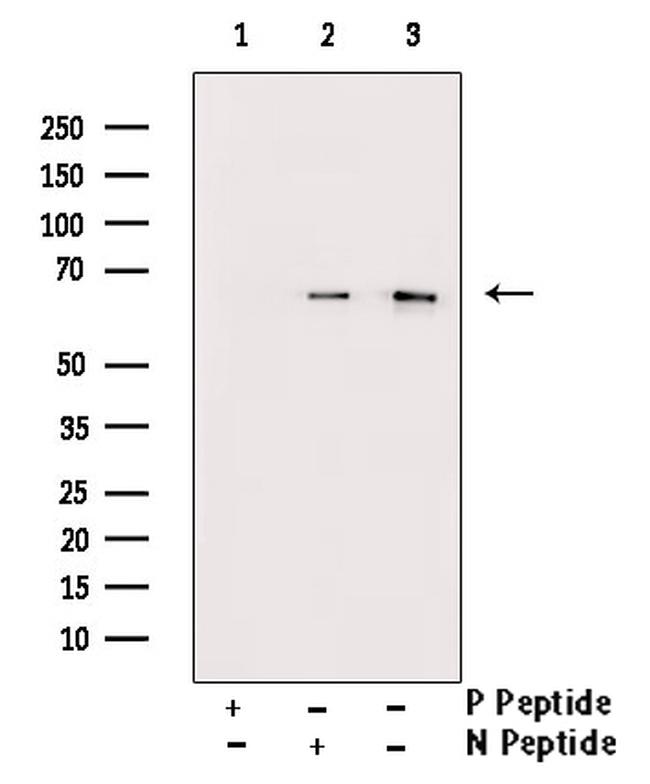 Phospho-AMPK alpha-1,2 (Thr172) Antibody in Western Blot (WB)