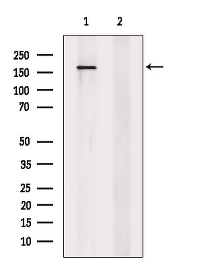 Phospho-AS160 (Ser588) Antibody in Western Blot (WB)