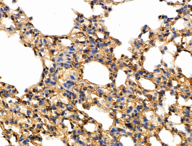 Phospho-Caspase 8 (Tyr380) Antibody in Immunohistochemistry (Paraffin) (IHC (P))