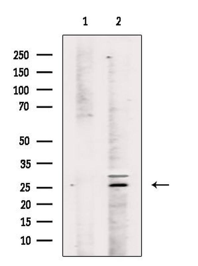 Phospho-Caspase 8 (Tyr380) Antibody in Western Blot (WB)