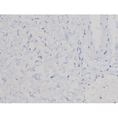 Phospho-Cdc25A (Ser76) Antibody in Immunohistochemistry (Paraffin) (IHC (P))