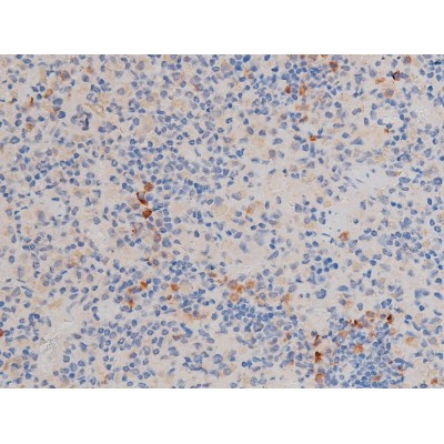 Phospho-Cdc25A (Ser76) Antibody in Immunohistochemistry (Paraffin) (IHC (P))