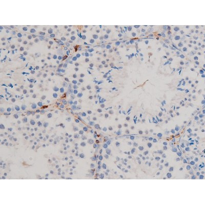 Phospho-Cdc25A (Ser76) Antibody in Immunohistochemistry (Paraffin) (IHC (P))