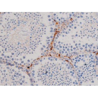 Phospho-Cdc25A (Ser76) Antibody in Immunohistochemistry (Paraffin) (IHC (P))