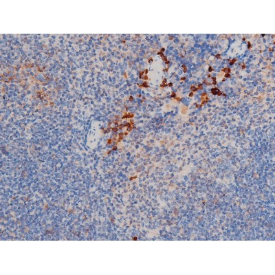 Phospho-Cdc25A (Ser76) Antibody in Immunohistochemistry (Paraffin) (IHC (P))