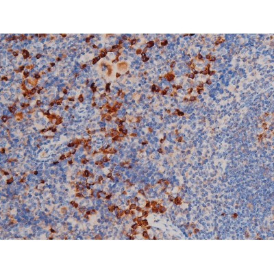 Phospho-Cdc25A (Ser76) Antibody in Immunohistochemistry (Paraffin) (IHC (P))