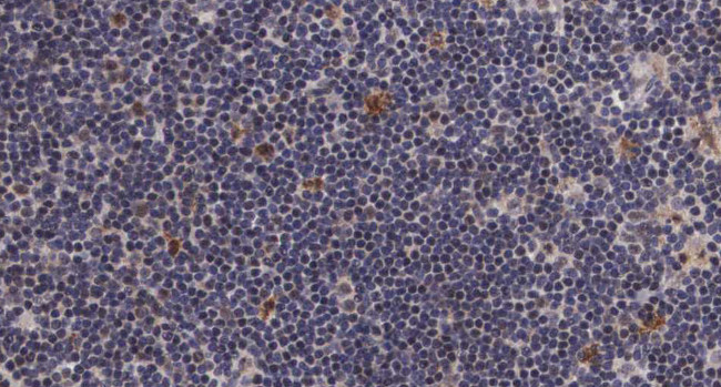 Phospho-Cdc25A (Ser76) Antibody in Immunohistochemistry (Paraffin) (IHC (P))