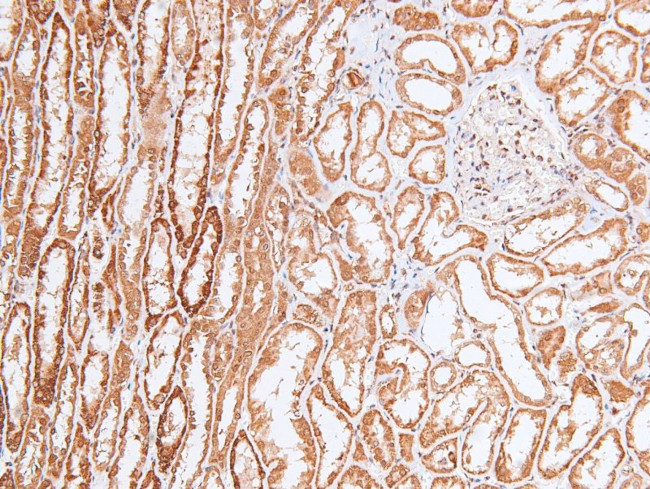 Phospho-Chk2 (Ser33, Ser35) Antibody in Immunohistochemistry (Paraffin) (IHC (P))