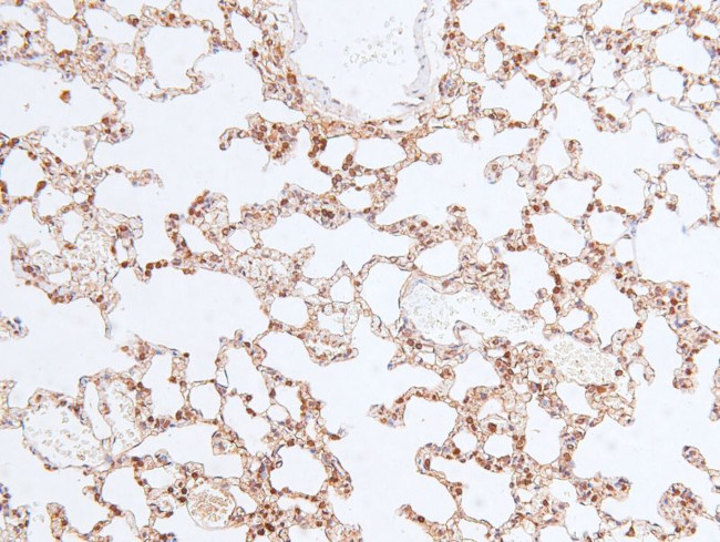 Phospho-Chk2 (Ser33, Ser35) Antibody in Immunohistochemistry (Paraffin) (IHC (P))