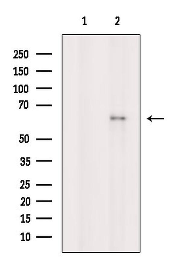 Phospho-Chk2 (Ser33, Ser35) Antibody in Western Blot (WB)