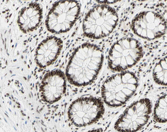 Phospho-C-Jun (Ser73) Antibody in Immunohistochemistry (Paraffin) (IHC (P))