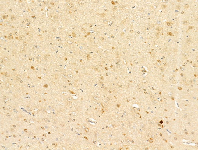 Phospho-C-Jun (Ser73) Antibody in Immunohistochemistry (Paraffin) (IHC (P))