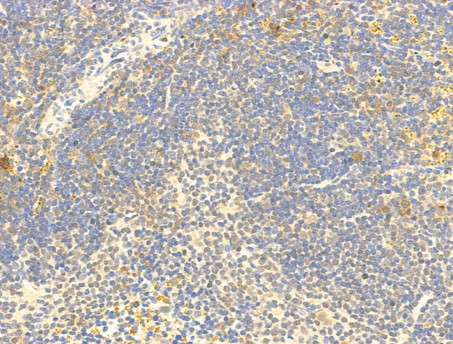 Phospho-C-Jun (Ser73) Antibody in Immunohistochemistry (Paraffin) (IHC (P))