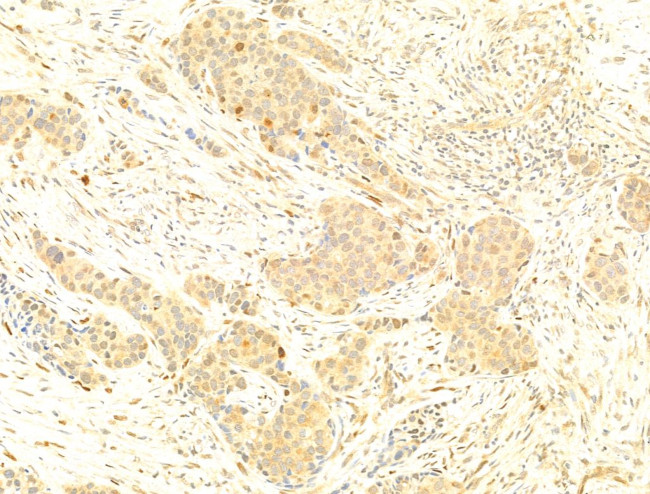 Phospho-C-Jun (Ser73) Antibody in Immunohistochemistry (Paraffin) (IHC (P))