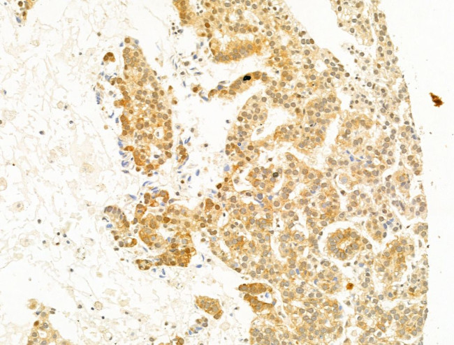 Phospho-C-Jun (Ser73) Antibody in Immunohistochemistry (Paraffin) (IHC (P))