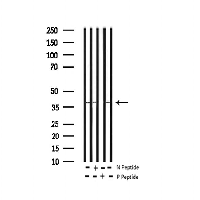 Phospho-C-Jun (Ser73) Antibody in Western Blot (WB)