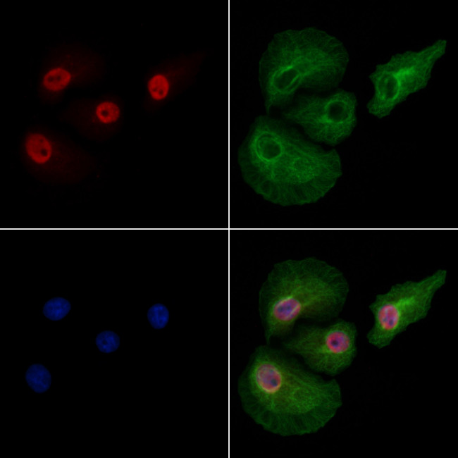 Phospho-DNMT1 (Ser714) Antibody in Immunocytochemistry (ICC/IF)