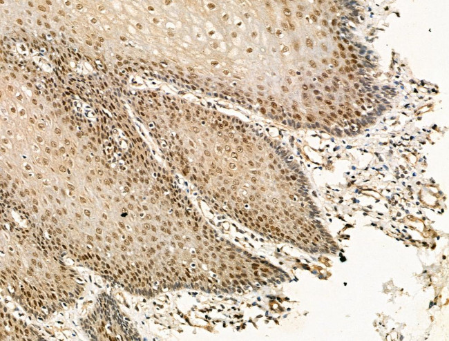 Phospho-DNMT1 (Ser714) Antibody in Immunohistochemistry (Paraffin) (IHC (P))