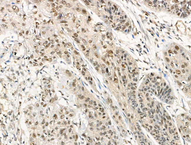 Phospho-DNMT1 (Ser714) Antibody in Immunohistochemistry (Paraffin) (IHC (P))