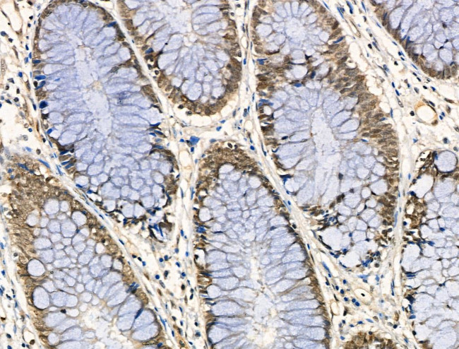 Phospho-DNMT1 (Ser714) Antibody in Immunohistochemistry (Paraffin) (IHC (P))