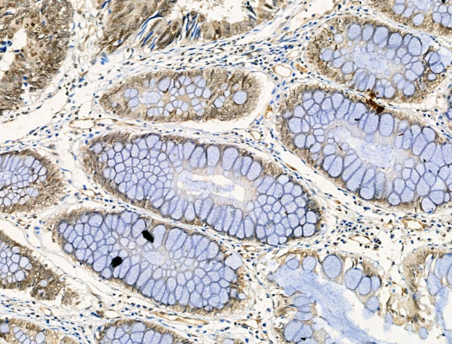 Phospho-DNMT1 (Ser714) Antibody in Immunohistochemistry (Paraffin) (IHC (P))