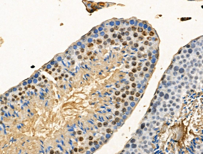 Phospho-DNMT1 (Ser714) Antibody in Immunohistochemistry (Paraffin) (IHC (P))