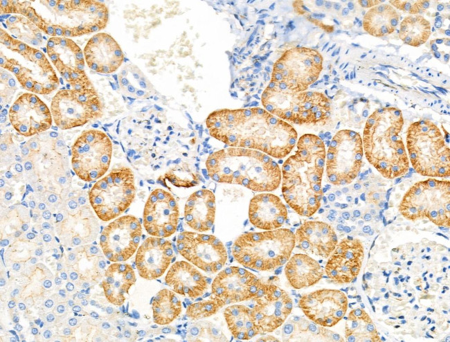 Phospho-EIF4B (Ser504) Antibody in Immunohistochemistry (Paraffin) (IHC (P))