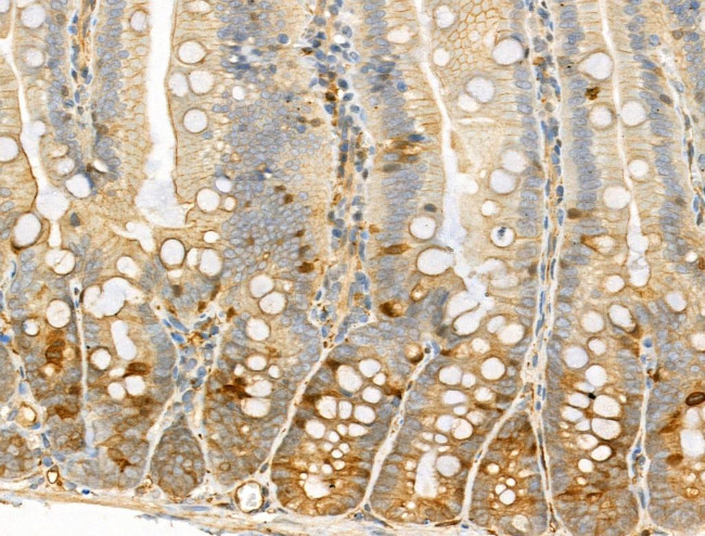 Phospho-EIF4B (Ser504) Antibody in Immunohistochemistry (Paraffin) (IHC (P))