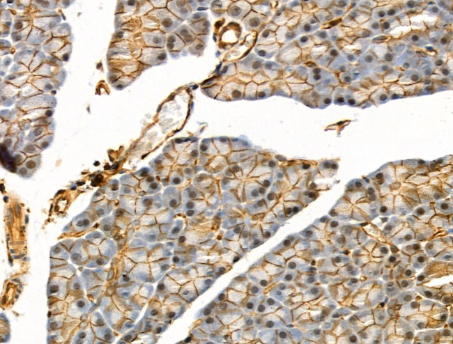 Phospho-EIF4B (Ser504) Antibody in Immunohistochemistry (Paraffin) (IHC (P))