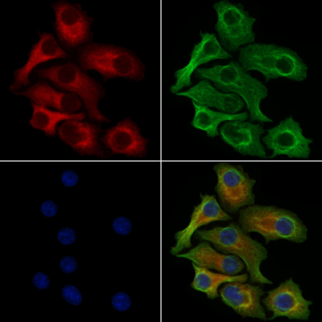 Phospho-EPRS (Ser886) Antibody in Immunocytochemistry (ICC/IF)