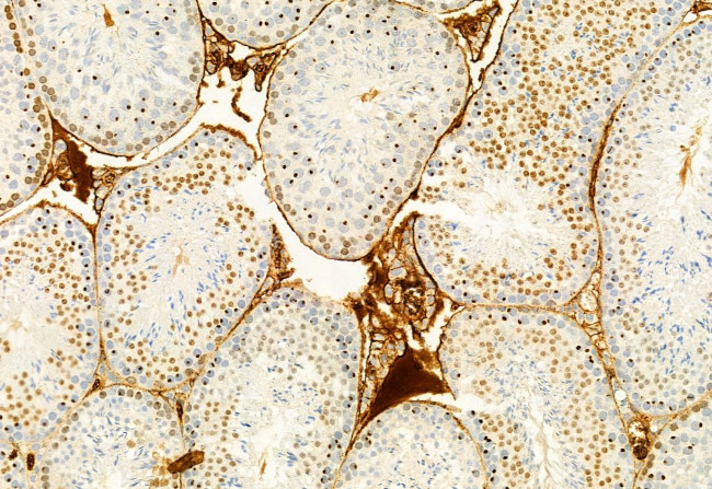 Phospho-ERK5 (Thr219, Tyr221) Antibody in Immunohistochemistry (Paraffin) (IHC (P))