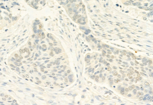 Phospho-ERK5 (Thr219, Tyr221) Antibody in Immunohistochemistry (Paraffin) (IHC (P))