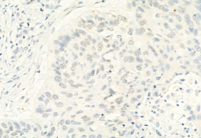 Phospho-ERK5 (Thr219, Tyr221) Antibody in Immunohistochemistry (Paraffin) (IHC (P))