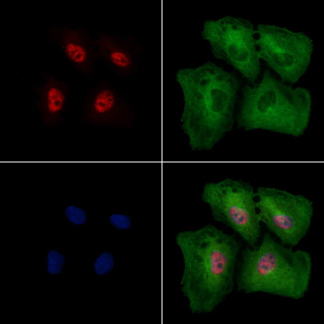 Phospho-EZH2 (Thr345) Antibody in Immunocytochemistry (ICC/IF)