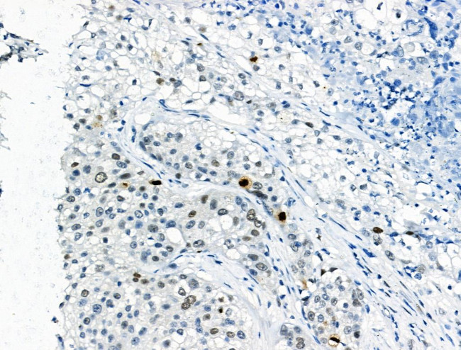 Phospho-EZH2 (Thr345) Antibody in Immunohistochemistry (Paraffin) (IHC (P))