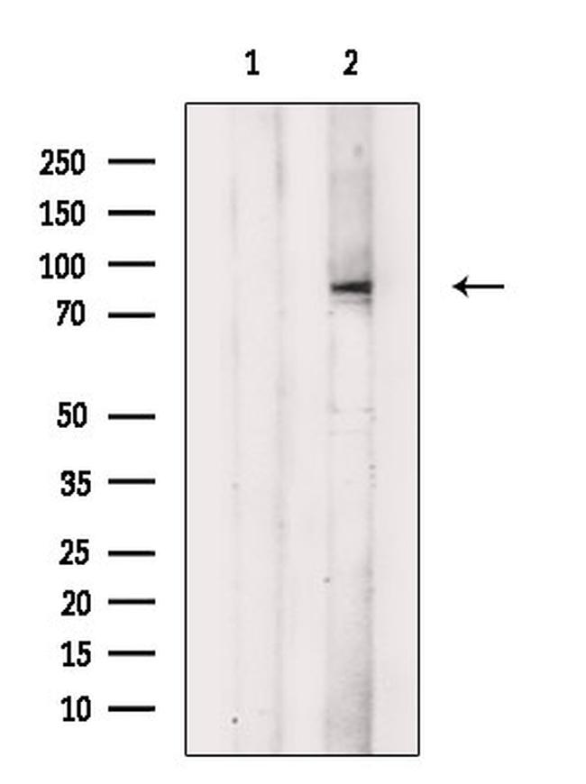 Phospho-HGS (Tyr216) Antibody in Western Blot (WB)