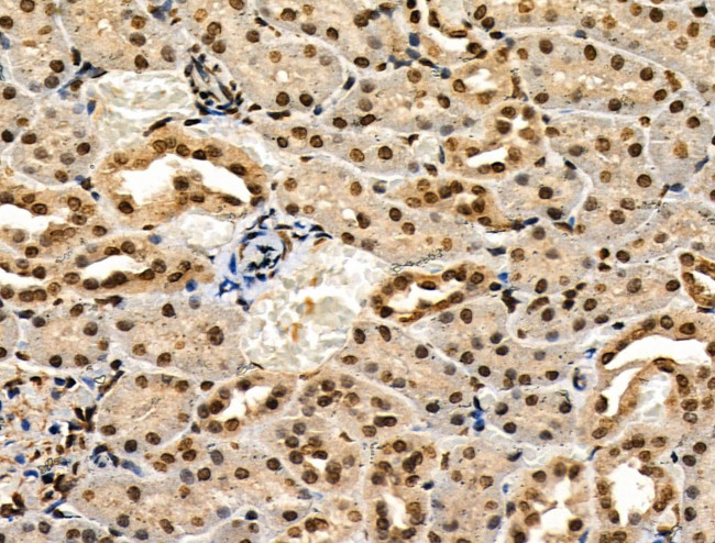 Phospho-IRF7 (Ser471, Ser472) Antibody in Immunohistochemistry (Paraffin) (IHC (P))