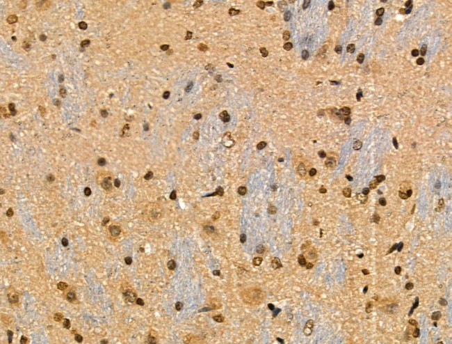 Phospho-IRF7 (Ser471, Ser472) Antibody in Immunohistochemistry (Paraffin) (IHC (P))