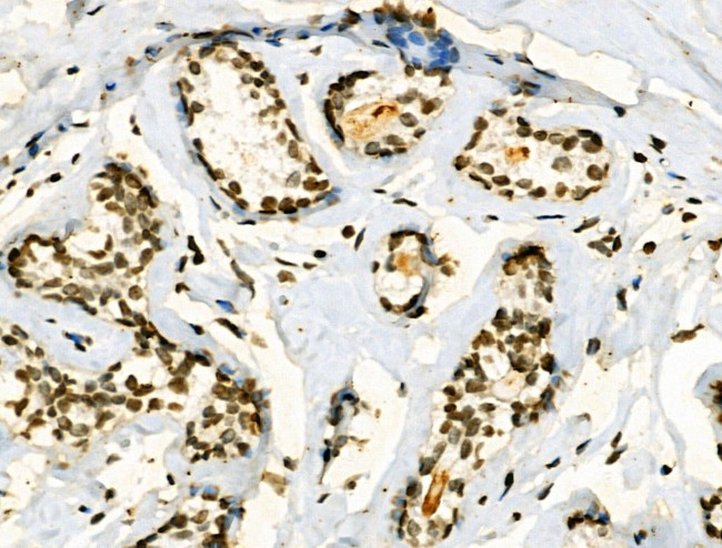 Phospho-JAK2 (Tyr1008) Antibody in Immunohistochemistry (Paraffin) (IHC (P))