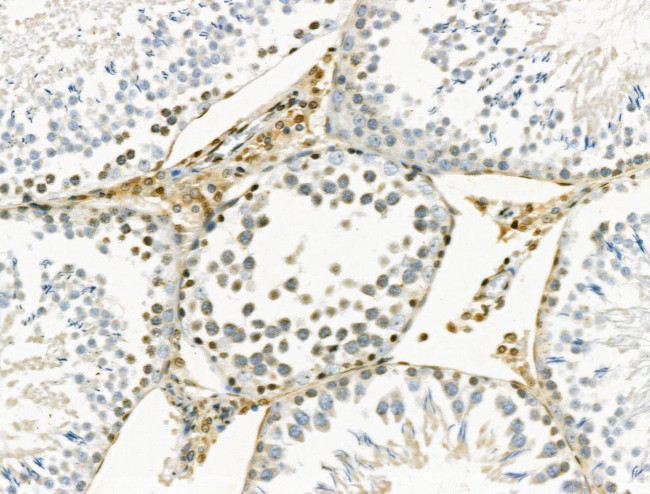 Phospho-JAK2 (Tyr1008) Antibody in Immunohistochemistry (Paraffin) (IHC (P))