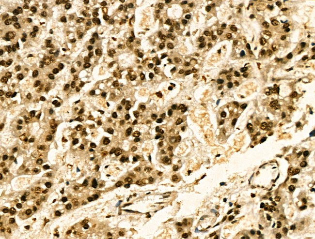 Phospho-JAK2 (Tyr1008) Antibody in Immunohistochemistry (Paraffin) (IHC (P))