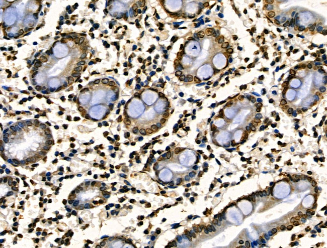 Phospho-JAK2 (Tyr1008) Antibody in Immunohistochemistry (Paraffin) (IHC (P))